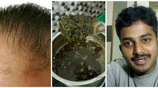 Hair Growth (Tips Remedies) Tamil, How To Grow Hair Fast, Hair Fall Control Tips, Mudi Valara Oi