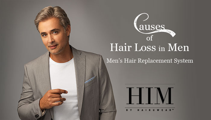 Causes of Hair Loss in Men – Men’s Hair Replacement System