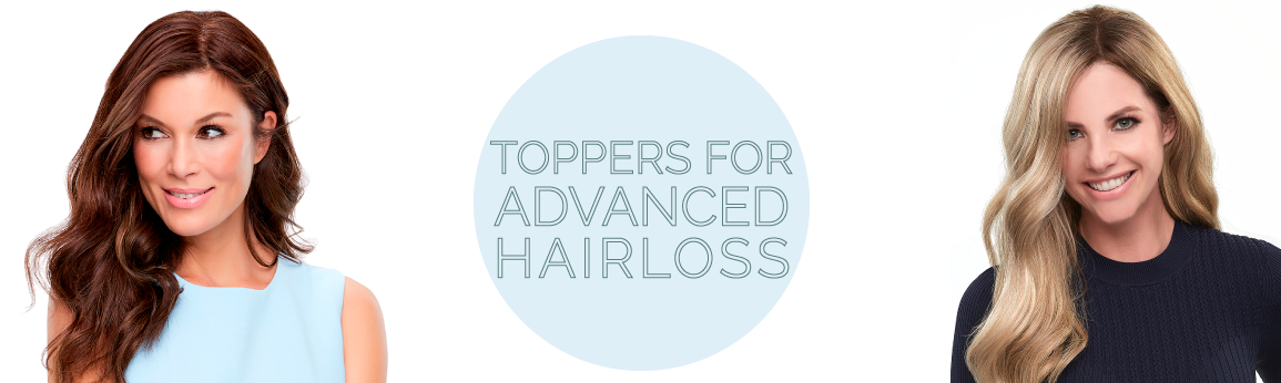 Toppers for Advanced Hair Loss