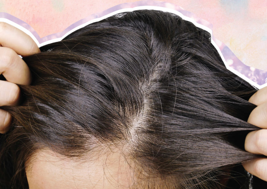 The Best NEW In-Office & At-Home Hair Loss Treatments