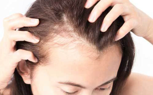 Can Traction Alopecia be Reversed?