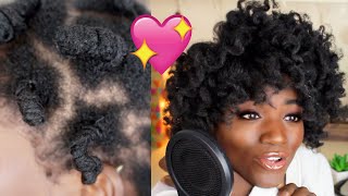 Thin 4C Hair Vs. Valentine'S Day | Starpuppy Vs. Styling