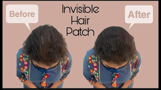 Invisible Hair Patch | Cover Up Your Hair Thinning | Hair Thinning Solution For Women | 1Hs