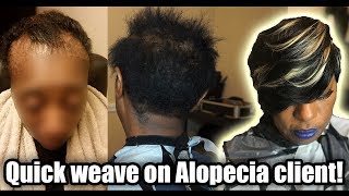 How To Quick Weave On A Client With Alopecia- No Audio