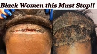 Must Watch~Hair Styles That Damage Black Women’S Hair
