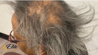 Short Quick Weave | Gray Hair Weave | Alopecia Regrowth