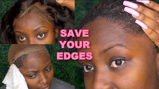 Stop Ripping Out Your Edges! | How To Properly Remove A Lace Frontal Install
