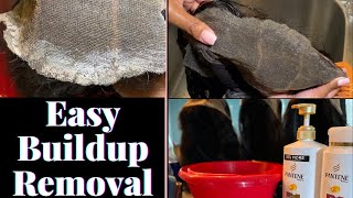 How To Remove Adhesive On Lace Wigs| Using Only Household Products!!