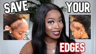 ‼️Save Your Edges Stop Doing This With Your Lace Wigs!!! ⚠️Tips For Hair Growth Ft. Nadula Hair