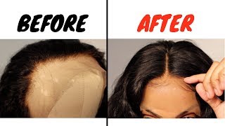 Fixing Over-Bleached Knots W/ Perfect Lace Wigs