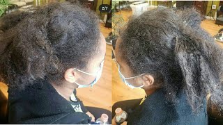 This Is One Heart Melting Transformation You Don'T Wanna Miss, Flawless Alopecia Hair Makeover