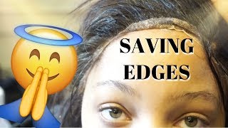 How To Remove Your Wig & Glue Without Damaging Your Edges