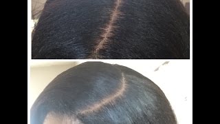 How To Train Silk Base Closuers, Lace Front  Wigs