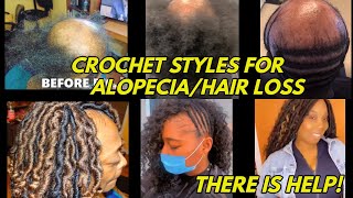 Amazing Crochet Hairstyles To Hide & Cover Alopecia, Hair Loss, Thin & Damaged Hair
