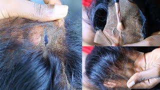 How To: Fast & Easy Fix A Torn Or Ripped Lace Closure/Frontal Wig With Extra Tips Headmistress