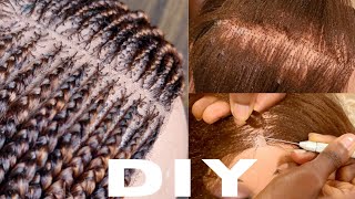 How To Make Closure For Braided Wigs #Braidedwigsforblackwomen