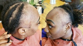 This Is One Extremely Gorgeous Transformation Not To Miss, Extreme Alopecia Hair Makeover