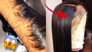 Diy: How To Bleach Knots Perfectly Natural Look |Beginner Friendly | Step By Step