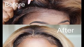 How To Repair A Bald Frontal/ Making Baby Hairs