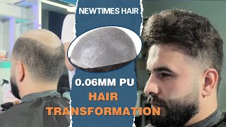 0.06Mm Thin Skin Hair System Transformation In A Local Salon | New Times Hair #Shorts