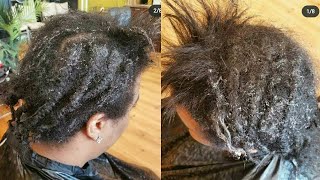 This Was One Difficult Transformation, She Had Hair Full Of Glue, Extreme Alopecia Hair Makeover