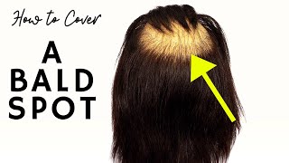 How To Fix A Bald Spot - Thesalonguy