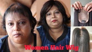 Ladies Hair Wigs | Ladies Hair Wigs In Noida | Non Surgical Hair Replacement For Women | Alopecia
