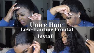 Step By Step Low Hairline Frontal Install | Amazon Unice Hair
