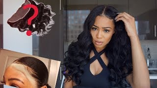 Wearing Frontals Again? How I Healed My Forehead!