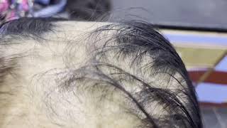 Hair Problem Solution || Nishalambha  || Hair Wigs || Human Hair Extension || Permanent ||2021