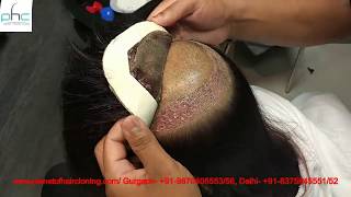 Ladies Hair Wigs 8375845551 Price | Ladies Hair Wigs Online | Ladies Hair Wigs Service Delhi