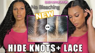 This Is Scalp! | Easily Hide Grids And Knots No Bleach On Wig (What Lace?)