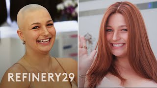 Styling Wigs With Alopecia | Hair Me Out | Refinery29
