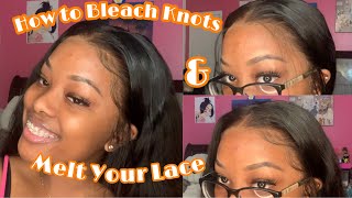 How To Bleach Knots + Wig Install |  Very Detailed | Ft. Isee Hair ✨