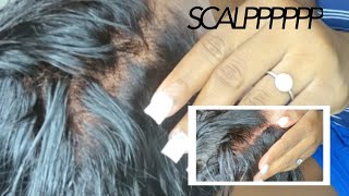 Beginner Friendly || How To: Properly Bleach Your Knots || Frontal Wig || Isee Hair