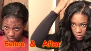 How To Fix Your Lace Closure!