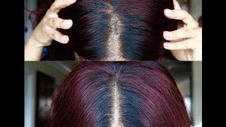 How To Fix Your Old Lace Frontal/Closure To Look Natural
