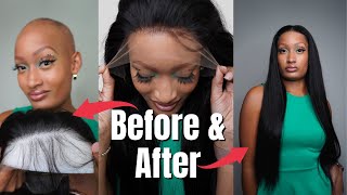 Everything You Need To Know!! Alopecia Wig Install| West Kiss Hair