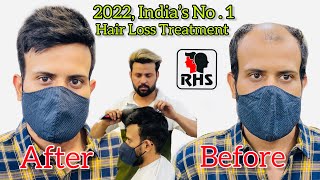 2022, India'S No .1 Hair Loss Treatment | Non Surgical Hair Replacement In India | 9599858612 !