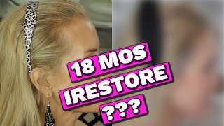 How To Cure Thinning Hair Naturally | See My Irestore 18 Months Results | Follow My Hair Growth
