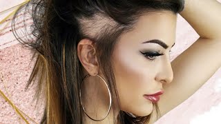 My Hair Loss Story | Stop Doing This Or It Will Happen To You | Traction Alopecia