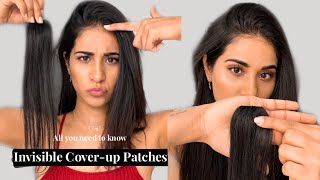Cover Up Patches | Cover Up Your Bald Spot With A Snap! Clip-In Extensions | Hair Thinning Solution
