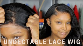 It'S Giving Scalp!! Start To Finish! Frontal Wig Install For Beginners (Very Detailed!) | Yunni