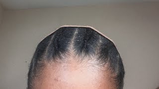 Easy Flat Braids For Under Wigs!