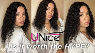 Unice Hair| Amazon| Fake Scalp| Install