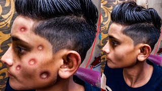 How To Get Boy Hair Cutting 2022 & Pimple Remove From:-Best Barber