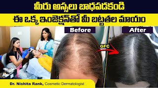100% Result For Bald Head In Women | Hair Transplantation In Women | Gfc | Dr Nishitha