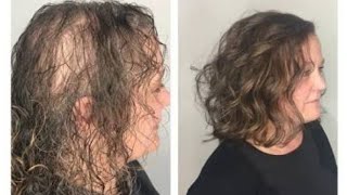 Flipcart/Amazon Hair Topper  Review N Demo