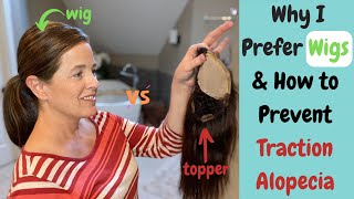 Hair Loss In Women, 10 Reasons Why I Prefer Wigs Over Toppers, Tips For Preventing Traction Alopecia