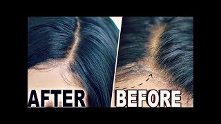How To "Hide Lace" & Wig Cap Lace Wigs!  -Fake Scalp Method ( Original Creator)